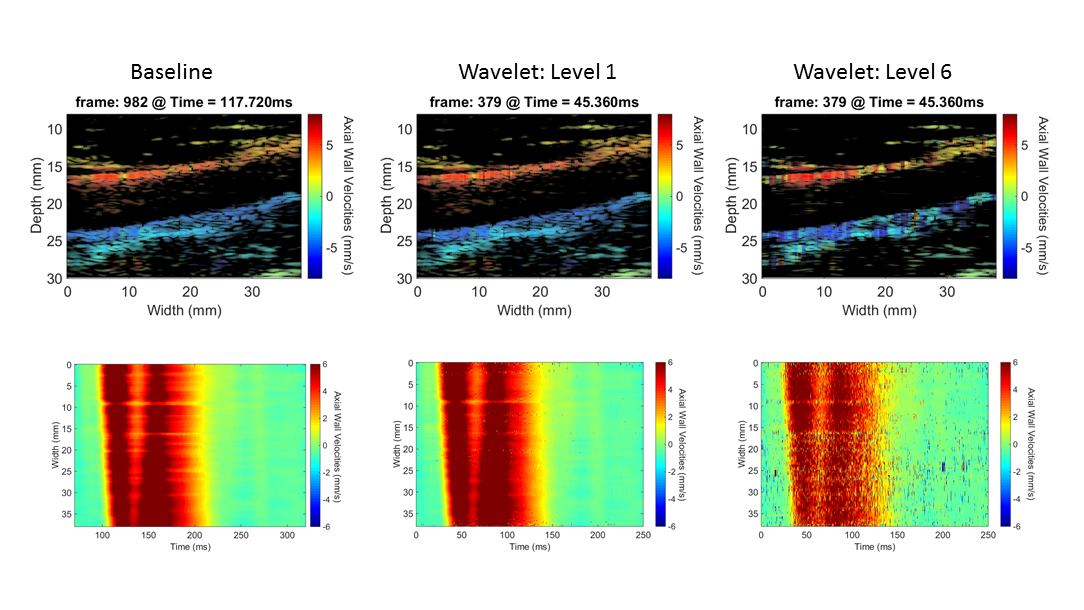 PWI images at specific time instants (top), and the spatio-temporal imaging of pulse-wave propagation (bottom). 